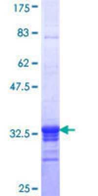 SDS-Page: Recombinant Human SF3B2 Protein [H00010992-Q01] - 12.5% SDS-PAGE Stained with Coomassie Blue.