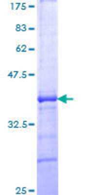 12.5% SDS-PAGE Stained with Coomassie Blue.