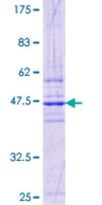 12.5% SDS-PAGE Stained with Coomassie Blue.