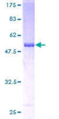 12.5% SDS-PAGE Stained with Coomassie Blue.