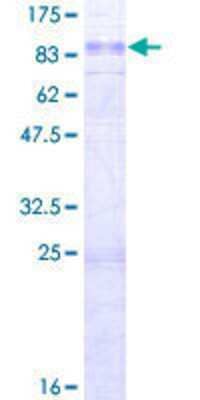 12.5% SDS-PAGE Stained with Coomassie Blue.