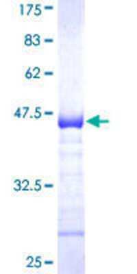 12.5% SDS-PAGE Stained with Coomassie Blue.