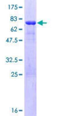 12.5% SDS-PAGE Stained with Coomassie Blue.