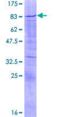 12.5% SDS-PAGE Stained with Coomassie Blue.