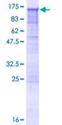 12.5% SDS-PAGE Stained with Coomassie Blue.