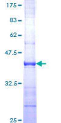 12.5% SDS-PAGE Stained with Coomassie Blue.