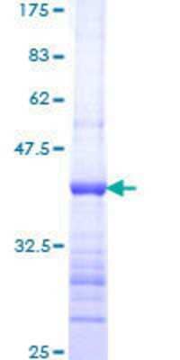 Other Recombinant Human ADAMTS8 GST (N-Term) Protein