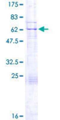 12.5% SDS-PAGE Stained with Coomassie Blue.