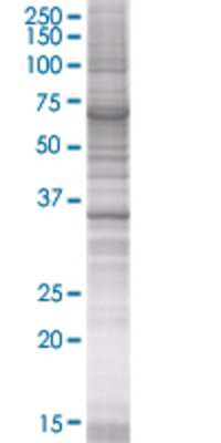 KATNA1 transfected lysate