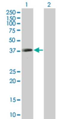 Lane 1: KATNA1 transfected lysate (34.32 KDa). Lane 2: Non-transfected lysate.
