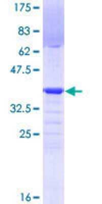 12.5% SDS-PAGE Stained with Coomassie Blue.
