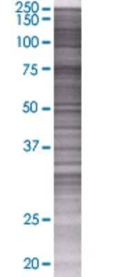 CAPN11 transfected lysate.