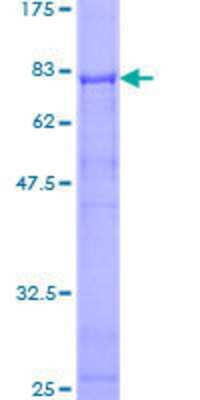 12.5% SDS-PAGE Stained with Coomassie Blue.