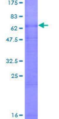 12.5% SDS-PAGE Stained with Coomassie Blue.