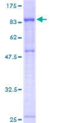 12.5% SDS-PAGE Stained with Coomassie Blue.