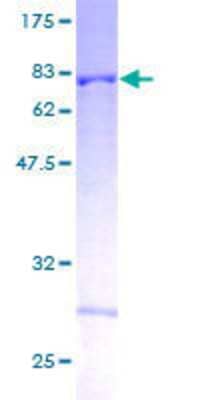 12.5% SDS-PAGE Stained with Coomassie Blue.