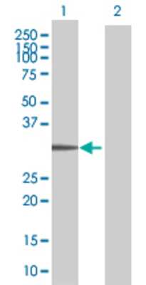 Lane 1: LDB3 transfected lysate (31 KDa) Lane 2: Non-transfected lysate.