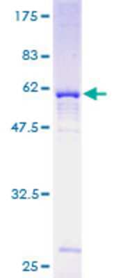 12.5% SDS-PAGE Stained with Coomassie Blue.