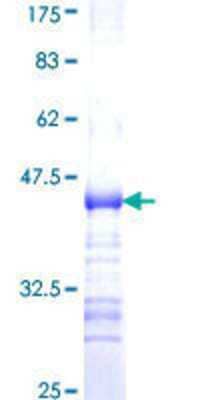 Other Recombinant Human ADAMTS7 GST (N-Term) Protein
