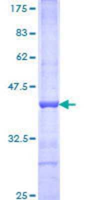 12.5% SDS-PAGE Stained with Coomassie Blue.