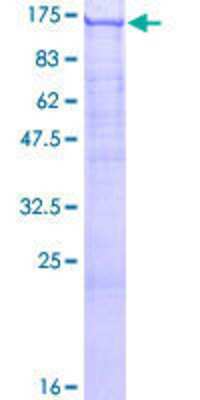 12.5% SDS-PAGE Stained with Coomassie Blue.