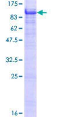 12.5% SDS-PAGE Stained with Coomassie Blue.