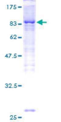 Other Recombinant Human IRAK3 GST (N-Term) Protein