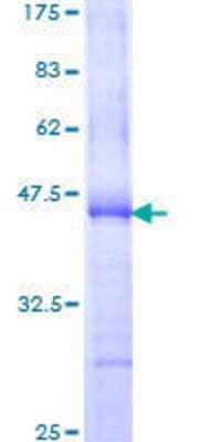 SDS-Page: Recombinant Human AKAP13 Protein [H00011214-Q01] - 12.5% SDS-PAGE Stained with Coomassie Blue.