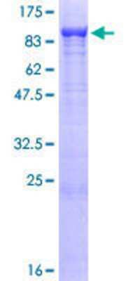 Other Recombinant Human AKAP10 GST (N-Term) Protein