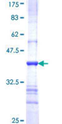 12.5% SDS-PAGE Stained with Coomassie Blue.