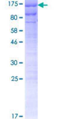 12.5% SDS-PAGE Stained with Coomassie Blue.