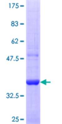 SDS-Page: Recombinant Human SEC63 Protein [H00011231-Q01] - 12.5% SDS-PAGE Stained with Coomassie Blue.