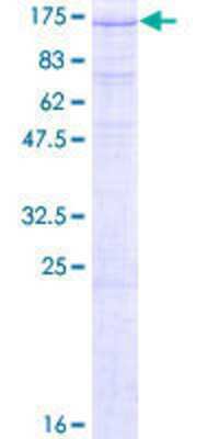 Recombinant Human ZHX1 Protein [H00011244-P01] - 12.5% SDS-PAGE Stained with Coomassie Blue.