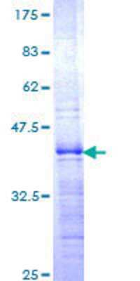 Recombinant Human ZHX1 Protein [H00011244-Q01] - 12.5% SDS-PAGE Stained with Coomassie Blue.