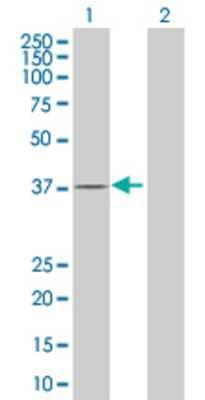 Lane 1: TP53AP1 transfected lysate (9.9 KDa) Lane 2: Non-transfected lysate.