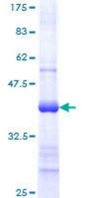 SDS-Page: Recombinant Human TREX1 Protein [H00011277-Q01] - 12.5% SDS-PAGE Stained with Coomassie Blue.