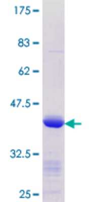SDS-Page: Recombinant Human KLF8 Protein [H00011279-Q01] - 12.5% SDS-PAGE Stained with Coomassie Blue.