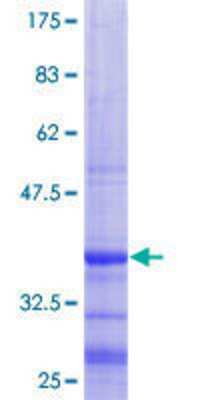 12.5% SDS-PAGE Stained with Coomassie Blue.