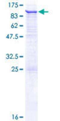 12.5% SDS-PAGE Stained with Coomassie Blue.