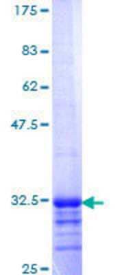 12.5% SDS-PAGE Stained with Coomassie Blue.
