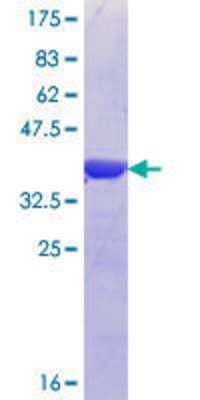 12.5% SDS-PAGE Stained with Coomassie Blue.