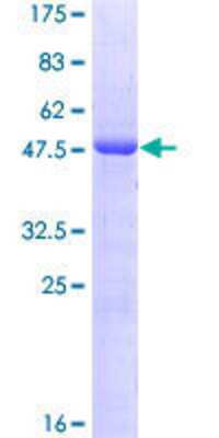 Other Recombinant Human OIP5 GST (N-Term) Protein