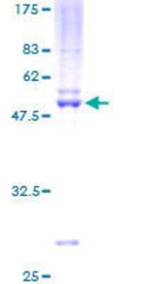 12.5% SDS-PAGE Stained with Coomassie Blue.