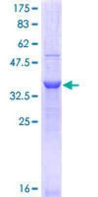 12.5% SDS-PAGE Stained with Coomassie Blue.
