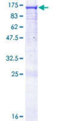 12.5% SDS-PAGE Stained with Coomassie Blue.