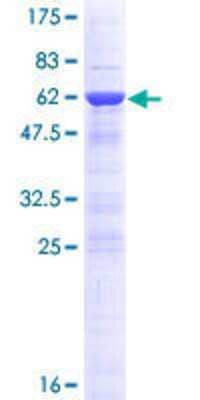 SDS-Page: Recombinant Human DNAJC8 Protein [H00022826-P01] - 12.5% SDS-PAGE Stained with Coomassie Blue.