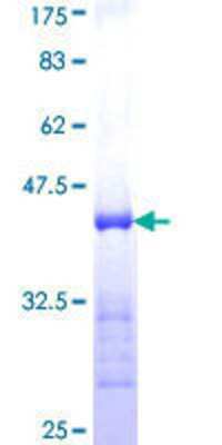 SDS-Page: Recombinant Human DZIP1 Protein [H00022873-Q01] - 12.5% SDS-PAGE Stained with Coomassie Blue.