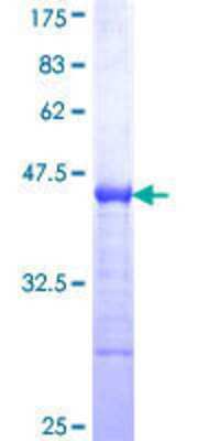 12.5% SDS-PAGE Stained with Coomassie Blue.