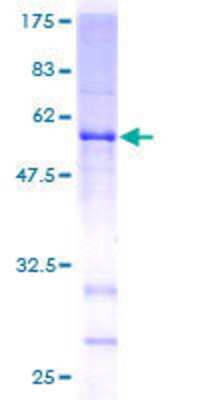 12.5% SDS-PAGE Stained with Coomassie Blue.
