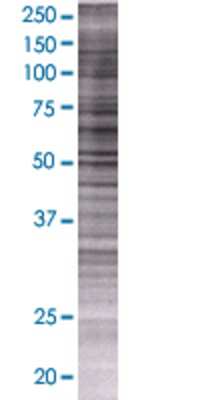 ARSG transfected lysate.